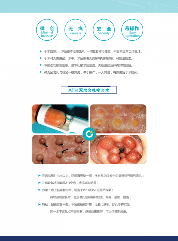 善謀善爲 加快推進器械審評審批改革工作 ——國家藥監局召開專題會研究器械審評審批改革思路舉措  